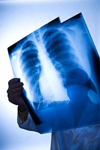 doctor holding x-ray
